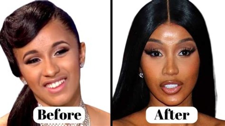 Discover The Hidden Truths: Cardi B Without Teeth
